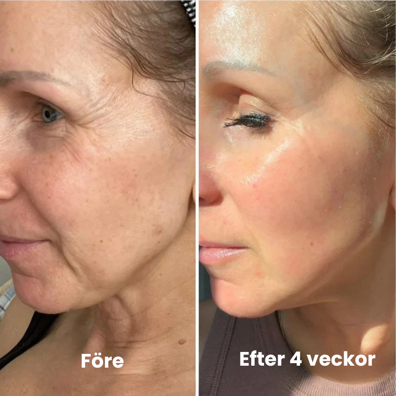 Vita-A Uppstramande Set (Serum + Booster)