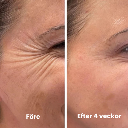 Vita-A Uppstramande Set (Serum + Booster)