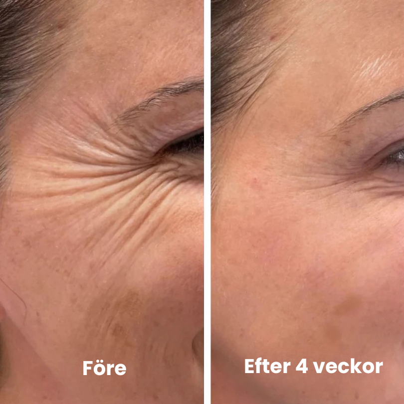 Vita-A Uppstramande Set (Serum + Booster)