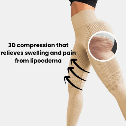 Instant relief & smaller legs in 14 days — for women carrying lipedema pain every day