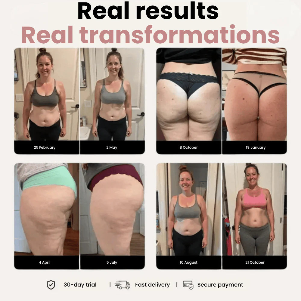 Instant relief & smaller legs in 14 days — for women carrying lipedema pain every day