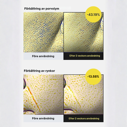 Vita-A Uppstramande Set (Serum + Booster)